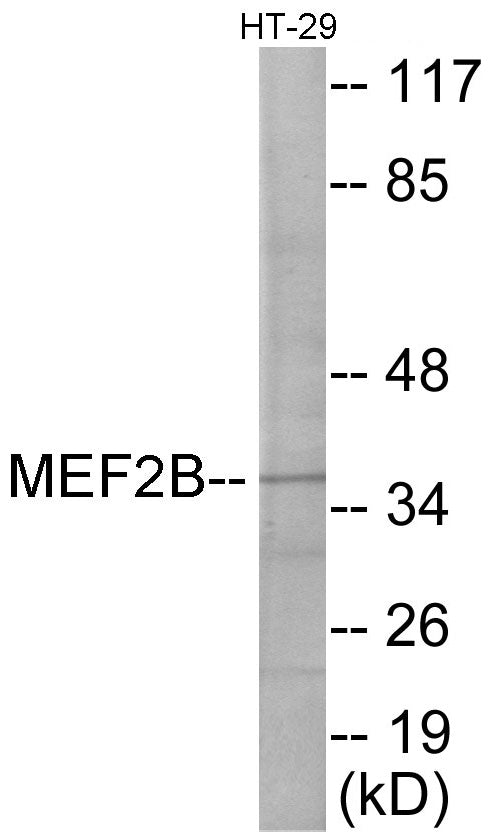 Western blot analysis of extracts from HT-29 cells, using MEF2B Antibody. The lane on the right is treated with the synthesized peptide.
