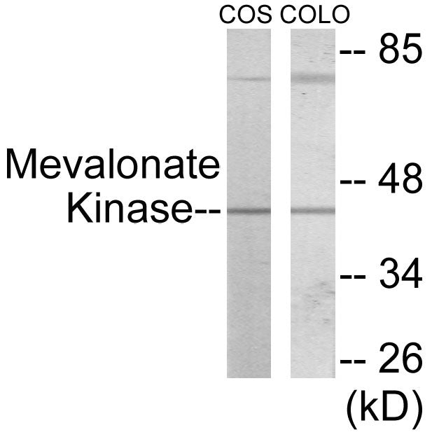 Western blot analysis of extracts from COS7/COLO205 cells, using Mevalonate Kinase Antibody.