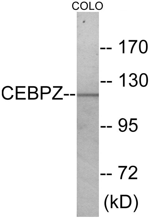 Western blot analysis of extracts from COLO cells, using CEBPZ Antibody. The lane on the right is treated with the synthesized peptide.