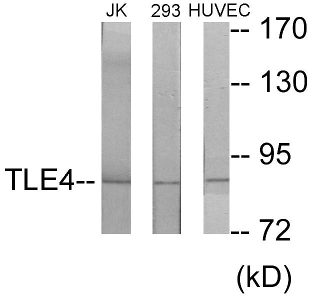 Western blot analysis of extracts from Jurkat/293/HuvEc cells, using TLE4 Antibody. The lane on the right is treated with the synthesized peptide.