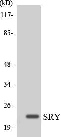 Western blot analysis of extracts from HeLa cells, using SRY Antibody. The lane on the right is treated with the synthesized peptide.