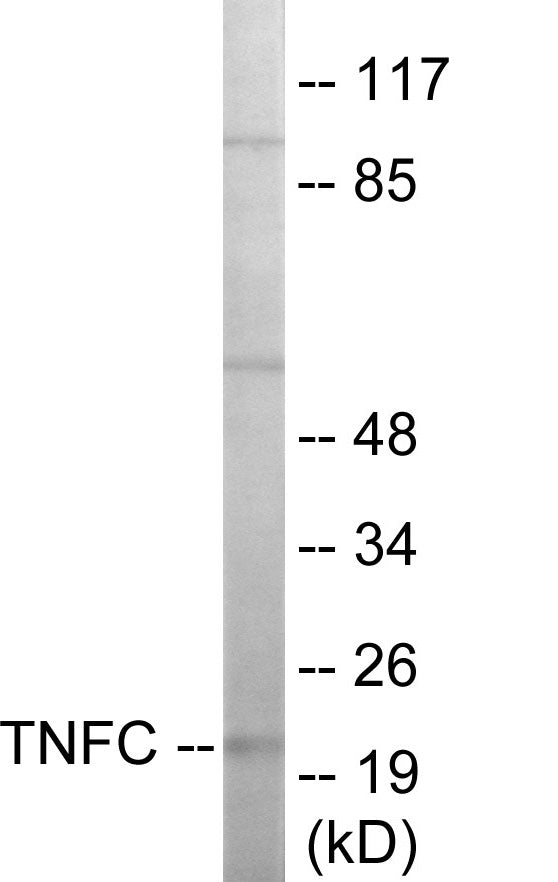 Western blot analysis of extracts from HepG2 cells, using TNFC Antibody.