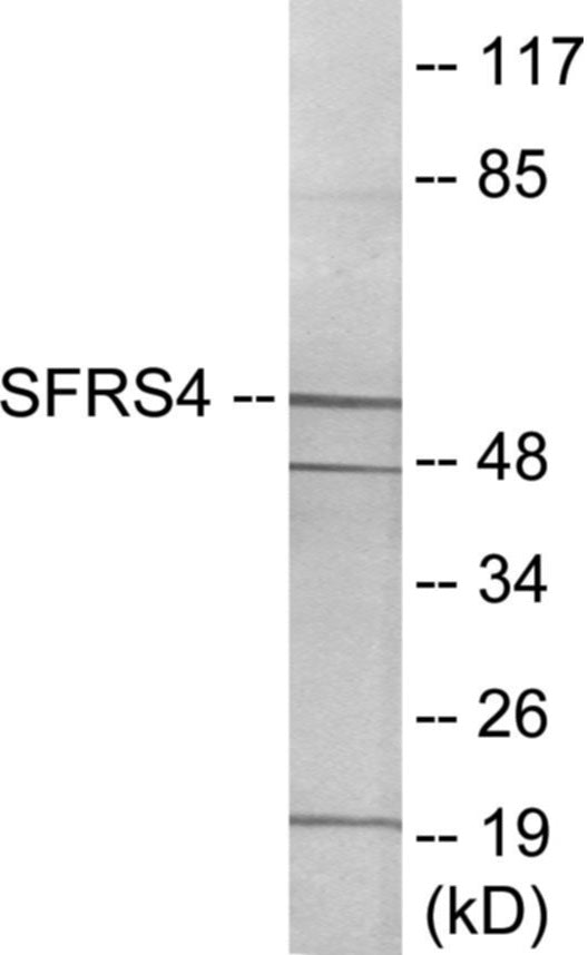 Western blot analysis of extracts from LOVO cells, using SFRS4 Antibody. The lane on the right is treated with the synthesized peptide.