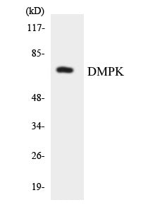 Western blot analysis of extracts from Jurkat/COLO205 cells, using DMPK Antibody. The lane on the right is treated with the synthesized peptide.