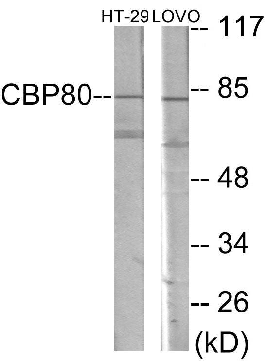 Western blot analysis of extracts from HT-29/LOVO cells, using NCBP1 Antibody. The lane on the right is treated with the synthesized peptide.