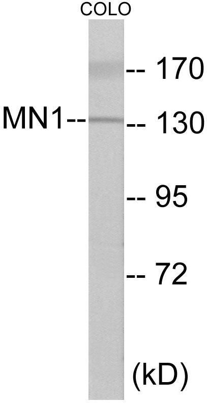 Western blot analysis of extracts from COLO cells, using MN1 Antibody. The lane on the right is treated with the synthesized peptide.
