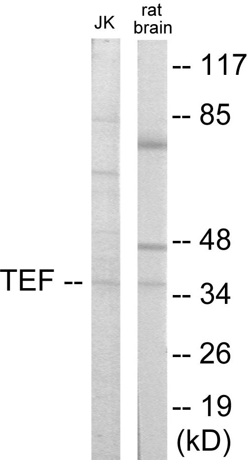 Western blot analysis of extracts from Jurkat/rat brain cells, using TEF Antibody. The lane on the right is treated with the synthesized peptide.
