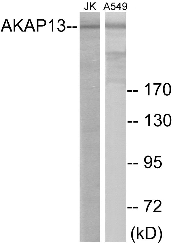 Western blot analysis of extracts from Jurkat/A549 cells, using AKAP13 Antibody.