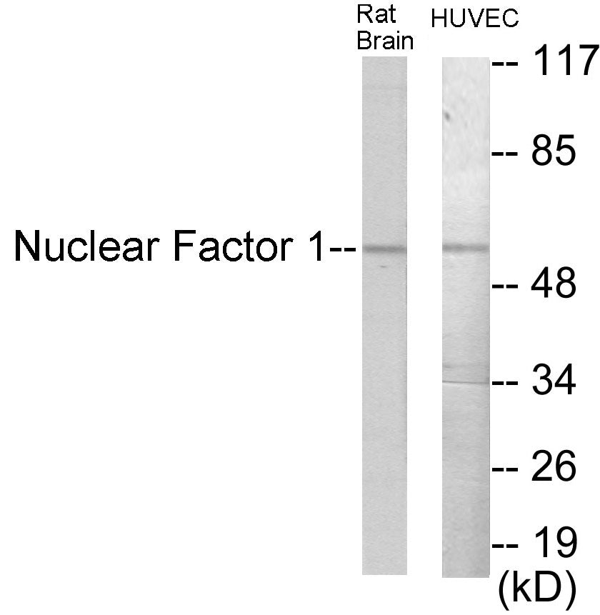 Western blot analysis of extracts from rat brain/HuvEc cells, using Nuclear Factor 1 Antibody. The lane on the right is treated with the synthesized peptide.
