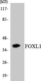 Western blot analysis of extracts from COS7/A549 cells, using FOXL1 Antibody. The lane on the right is treated with the synthesized peptide.