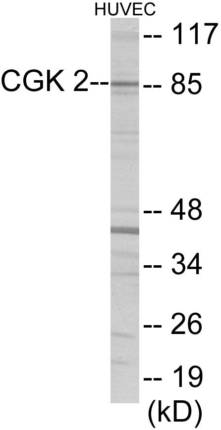 Western blot analysis of extracts from HuvEc cells, using CGK 2 Antibody. The lane on the right is treated with the synthesized peptide.