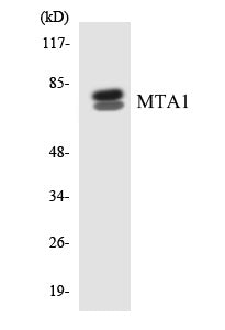 Western blot analysis of extracts from Jurkat cells, using MTA1 Antibody. The lane on the right is treated with the synthesized peptide.