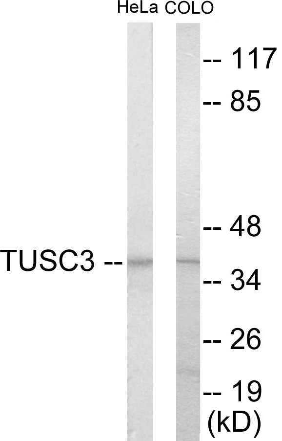 Western blot analysis of extracts from COLO205/HeLa cells, using TUSC3 Antibody.