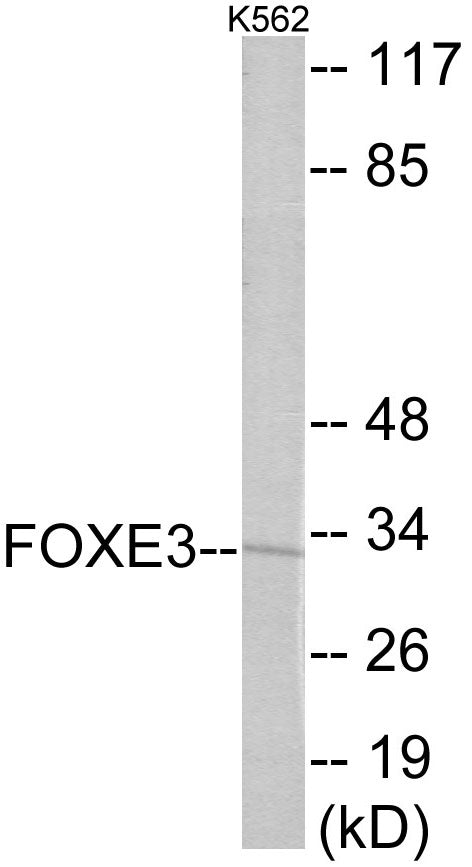 Western blot analysis of extracts from K562 cells, using FOXE3 Antibody. The lane on the right is treated with the synthesized peptide.