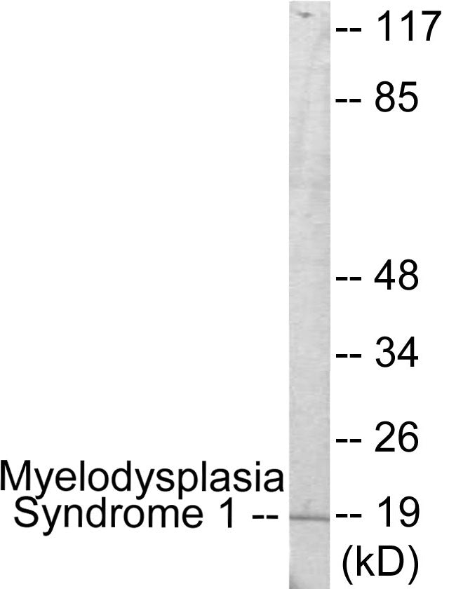 Western blot analysis of extracts from A549 cells, using Myelodysplasia Syndrome 1 Antibody. The lane on the right is treated with the synthesized peptide.