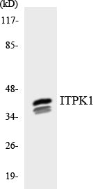 Western blot analysis of extracts from HeLa/HepG2/Jurkat cells, using ITPK1 Antibody. The lane on the right is treated with the synthesized peptide.