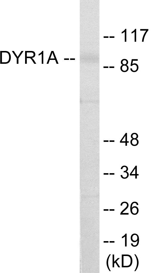 Western blot analysis of extracts from HepG2 cells, using DYR1A Antibody.