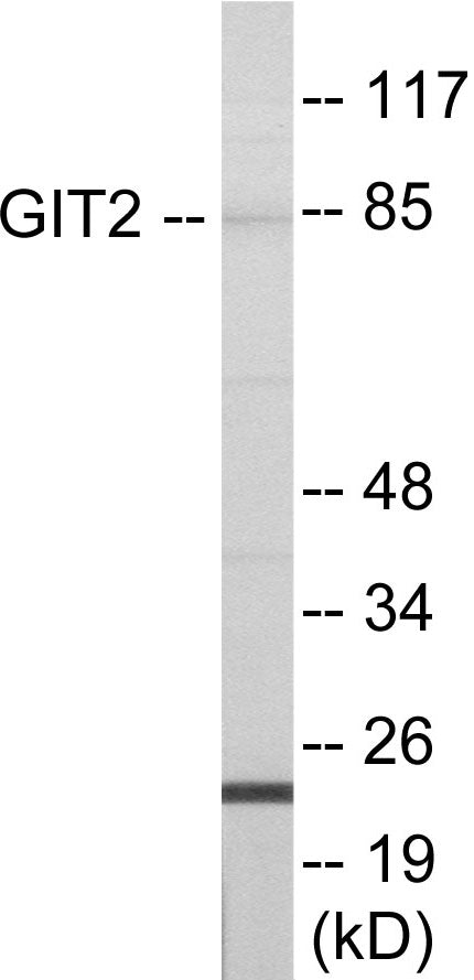 Western blot analysis of extracts from HepG2 cells, using GIT2 Antibody. The lane on the right is treated with the synthesized peptide.