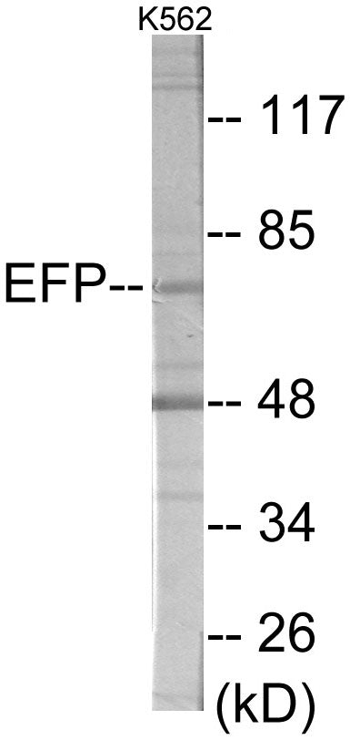 Western blot analysis of extracts from K562 cells, using ZNF147 Antibody. The lane on the right is treated with the synthesized peptide.