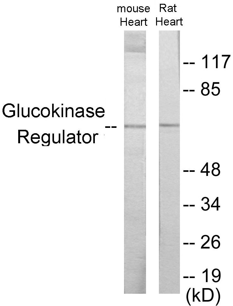 Western blot analysis of extracts from mouse heart/rat heart cells, using Glucokinase Regulator Antibody. The lane on the right is treated with the synthesized peptide.