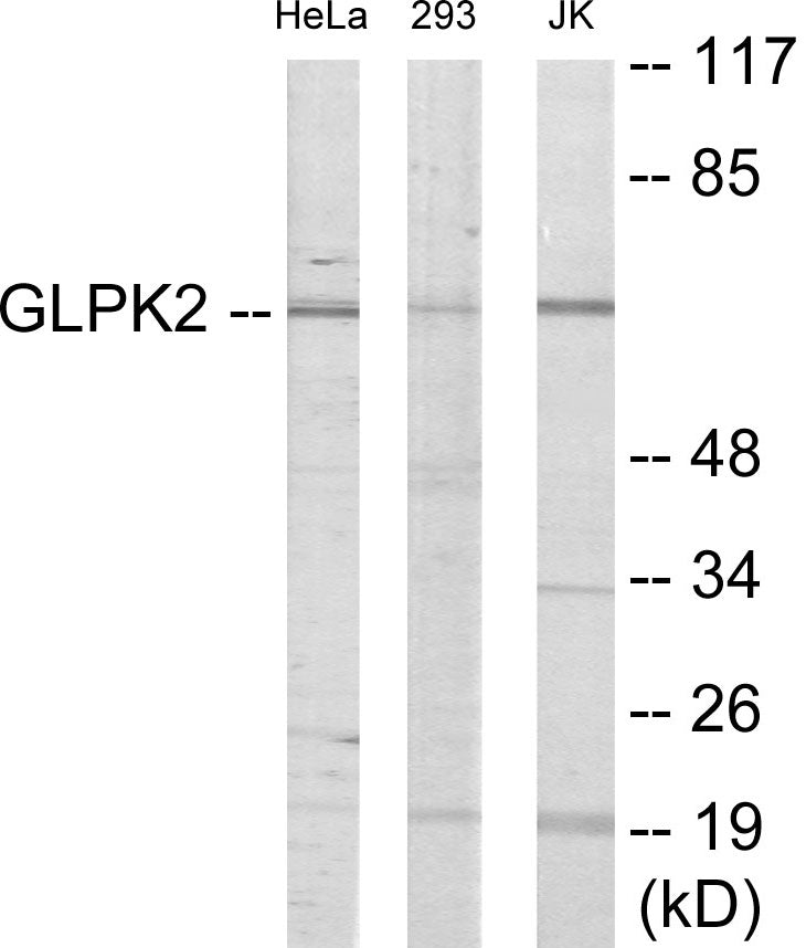 Western blot analysis of extracts from HeLa/293/Jurkat cells, using GK2 Antibody. The lane on the right is treated with the synthesized peptide.