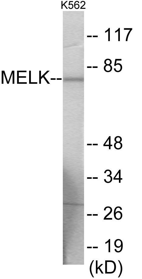 Western blot analysis of extracts from K562 cells, using MELK Antibody. The lane on the right is treated with the synthesized peptide.