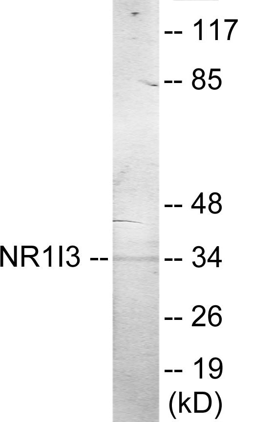 Western blot analysis of extracts from Jurkat cells, treated with serum 20% 15', using NR1I3 Antibody. The lane on the right is treated with the synthesized peptide.