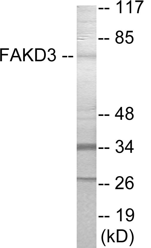 Western blot analysis of extracts from HepG2 cells, using FAKD3 Antibody. The lane on the right is treated with the synthesized peptide.
