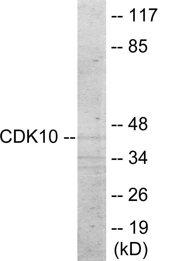 Western blot analysis of extracts from 293 cells, using CDK10 Antibody. The lane on the right is treated with the synthesized peptide.