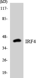 Western blot analysis of extracts from HeLa/Jurkat cells, using IRF4 Antibody. The lane on the right is treated with the synthesized peptide.