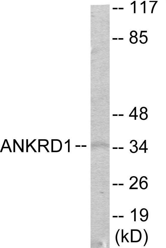 Western blot analysis of extracts from COLO205 cells, using ANKRD1 Antibody. The lane on the right is treated with the synthesized peptide.