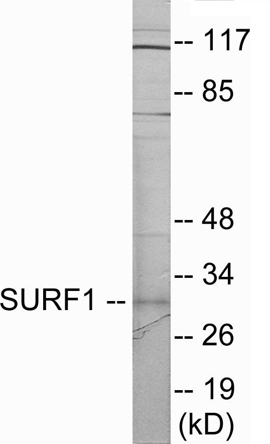 Western blot analysis of extracts from Jurkat cells, using SURF1 Antibody. The lane on the right is treated with the synthesized peptide.