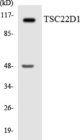 Western blot analysis of extracts from mouse liver/rat liver cells, using TSC22D1 Antibody.