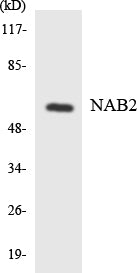 Western blot analysis of extracts from HT-29/RAW264.7 cells, using NAB2 Antibody.
