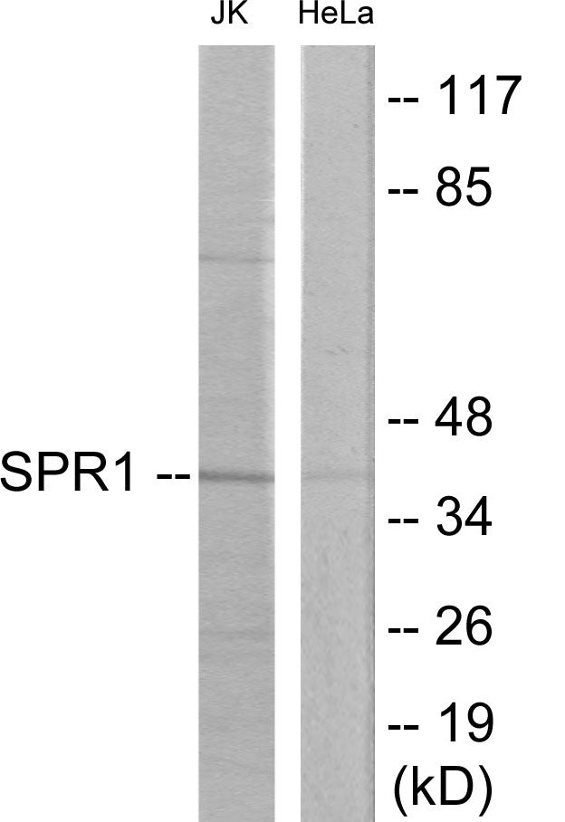 Western blot analysis of extracts from Jurkat/HeLa cells, using SPR1 Antibody. The lane on the right is treated with the synthesized peptide.