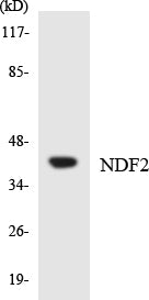 Western blot analysis of extracts from 293/COLO/Jurkat cells, using NDF2 Antibody. The lane on the right is treated with the synthesized peptide.