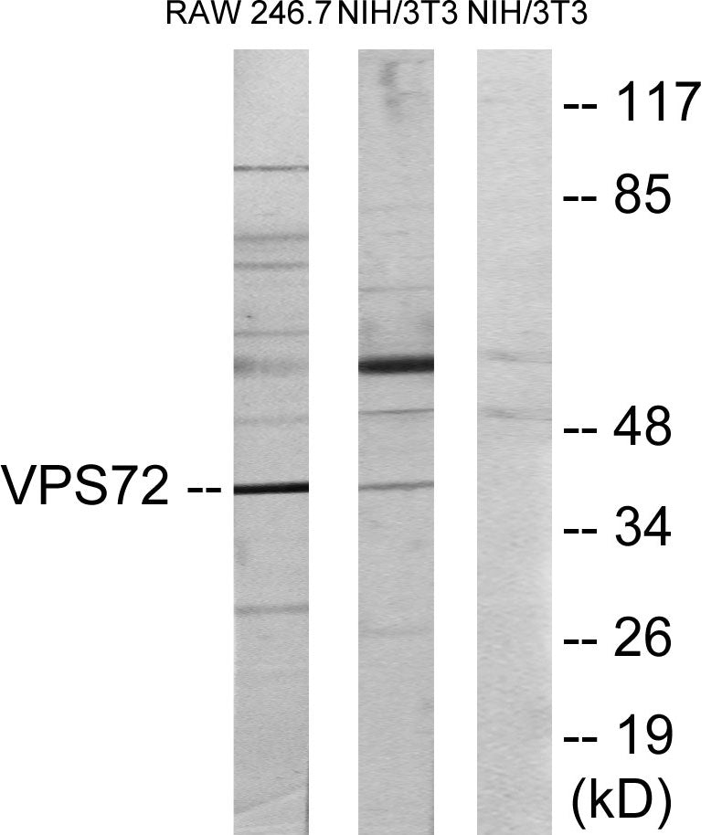 Western blot analysis of extracts from RAW264.7/NIH-3T3 cells, using VPS72 Antibody.