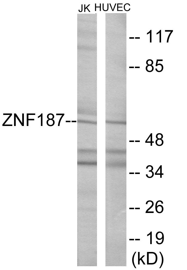 Western blot analysis of extracts from Jurkat/HuvEc cells, using ZNF187 Antibody.