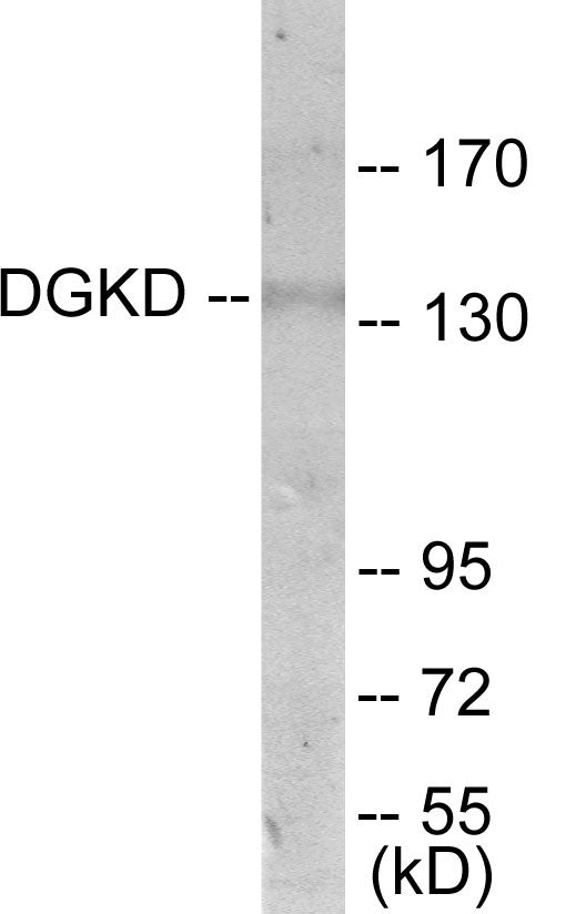 Western blot analysis of extracts from HuvEc cells, using DGKD Antibody. The lane on the right is treated with the synthesized peptide.