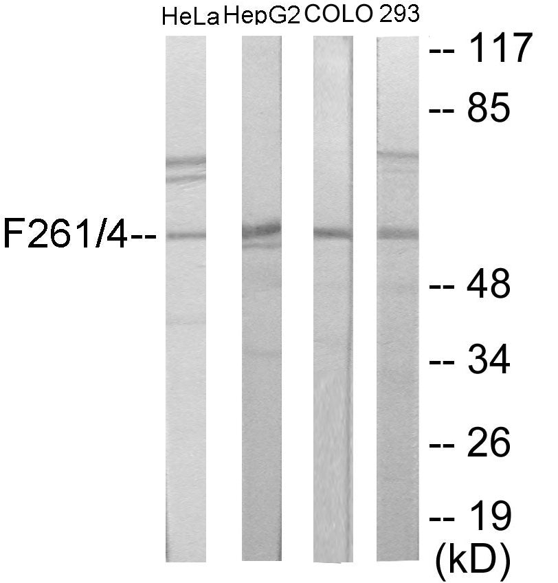 Western blot analysis of extracts from HeLa/HepG2/COLO205/293 cells, using PFKFB1/4 Antibody. The lane on the right is treated with the synthesized peptide.
