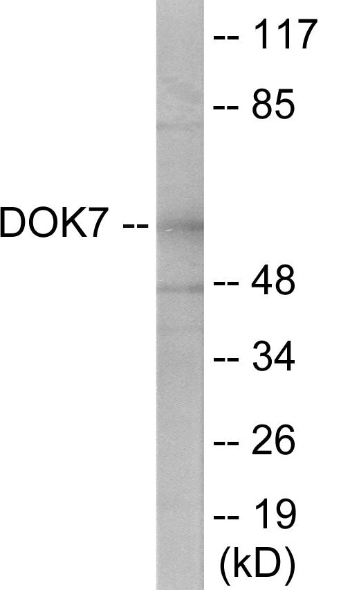 Western blot analysis of extracts from mouse brain cells, using DOK7 Antibody.