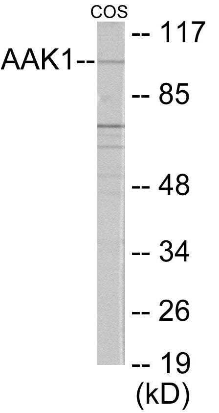 Western blot analysis of extracts from COS7 cells, using AAK1 Antibody. The lane on the right is treated with the synthesized peptide.