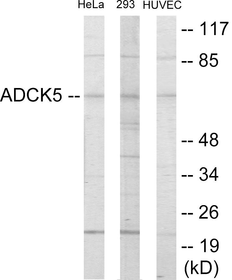 Western blot analysis of extracts from HeLa/293/HuvEc cells, using ADCK5 Antibody. The lane on the right is treated with the synthesized peptide.
