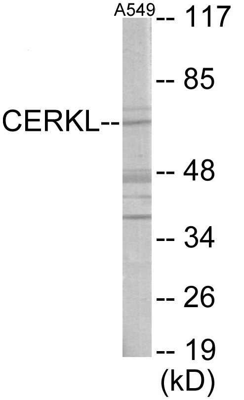 Western blot analysis of extracts from A549 cells, using CERKL Antibody. The lane on the right is treated with the synthesized peptide.