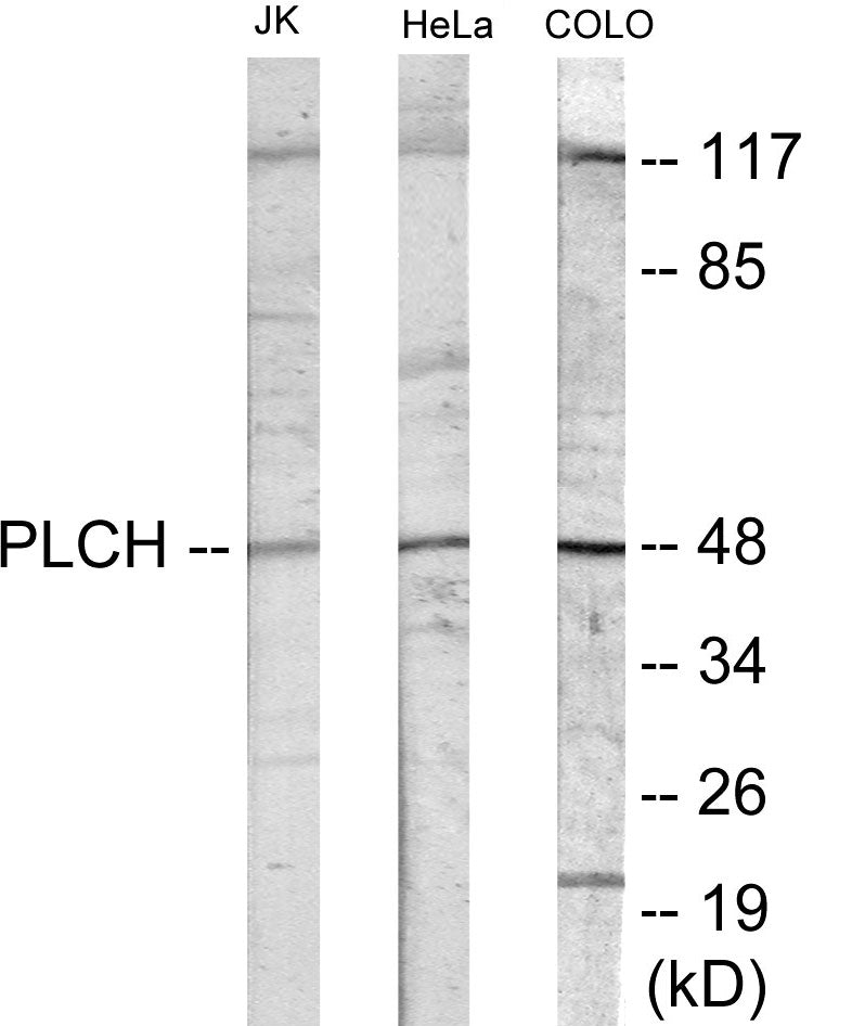 Western blot analysis of extracts from Jurkat cells/COLO205 cells/HeLa cells/HuvEc cells, using PLCH Antibody.