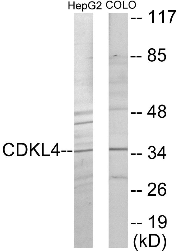 Western blot analysis of extracts from HepG2/COLO205 cells, using CDKL4 Antibody.