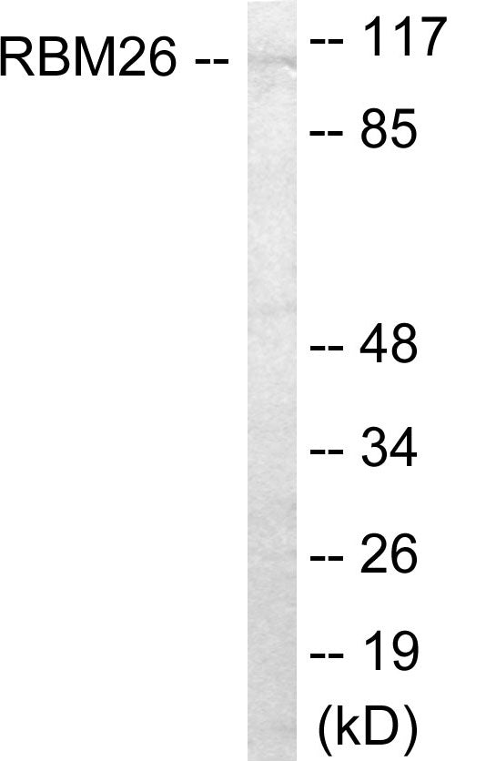Western blot analysis of extracts from Jurkat cells, using RBM26 Antibody. The lane on the right is treated with the synthesized peptide.