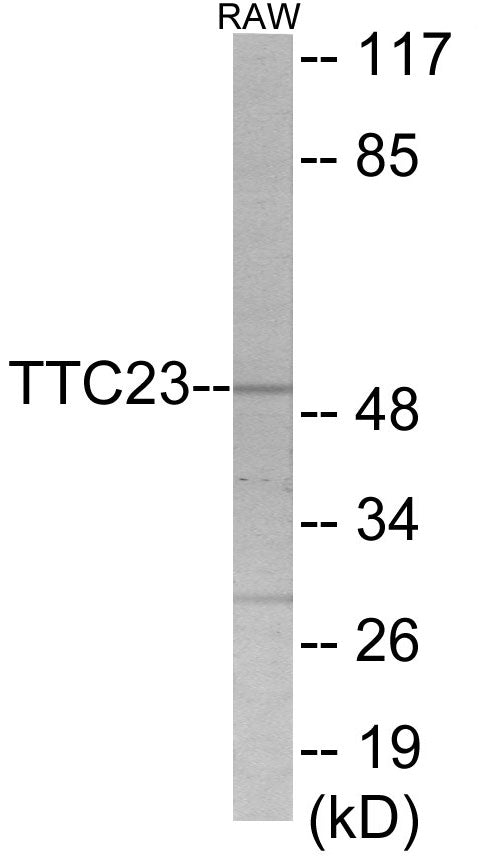 Western blot analysis of extracts from RAW264.7 cells, using TTC23 Antibody. The lane on the right is treated with the synthesized peptide.