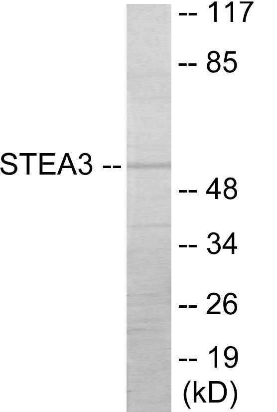Western blot analysis of extracts from COLO205 cells, using STEA3 Antibody.