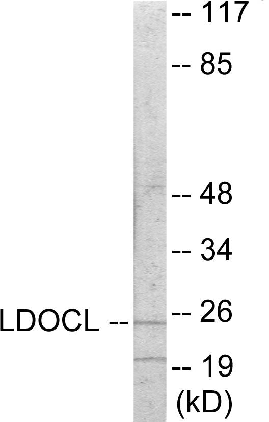 Western blot analysis of extracts from COLO205 cells, using LDOC1L Antibody. The lane on the right is treated with the synthesized peptide.